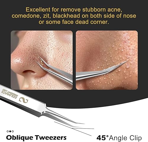 Miniatura 4 de WSYUB Pinzas profesionales para puntos negros, herramientas para quitar puntos negros,Kit de depilación encarnada