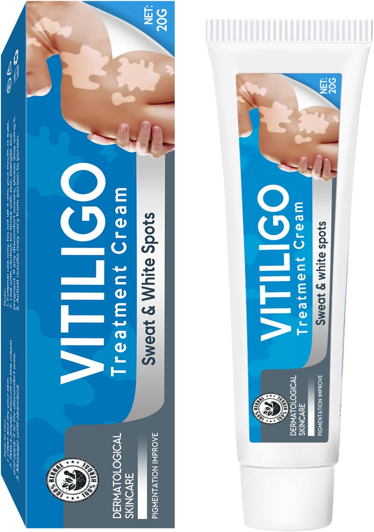 UpdateClassic Vitiligo Cream, Natural Vitiligo Treatment for Skin Vitiligo, Vitiligo Care Cream, Reduce White Spots and Improve Skin Pigmentation, Easy to Use