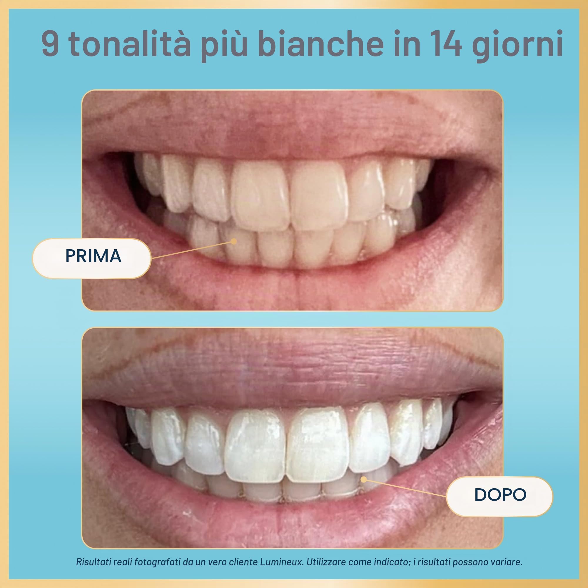 Lumineux Teeth Whitening Strips 7 Treatments - Enamel Safe - Whitening Without The Sensitivity - Dentist Formulated & Certified Non-Toxic