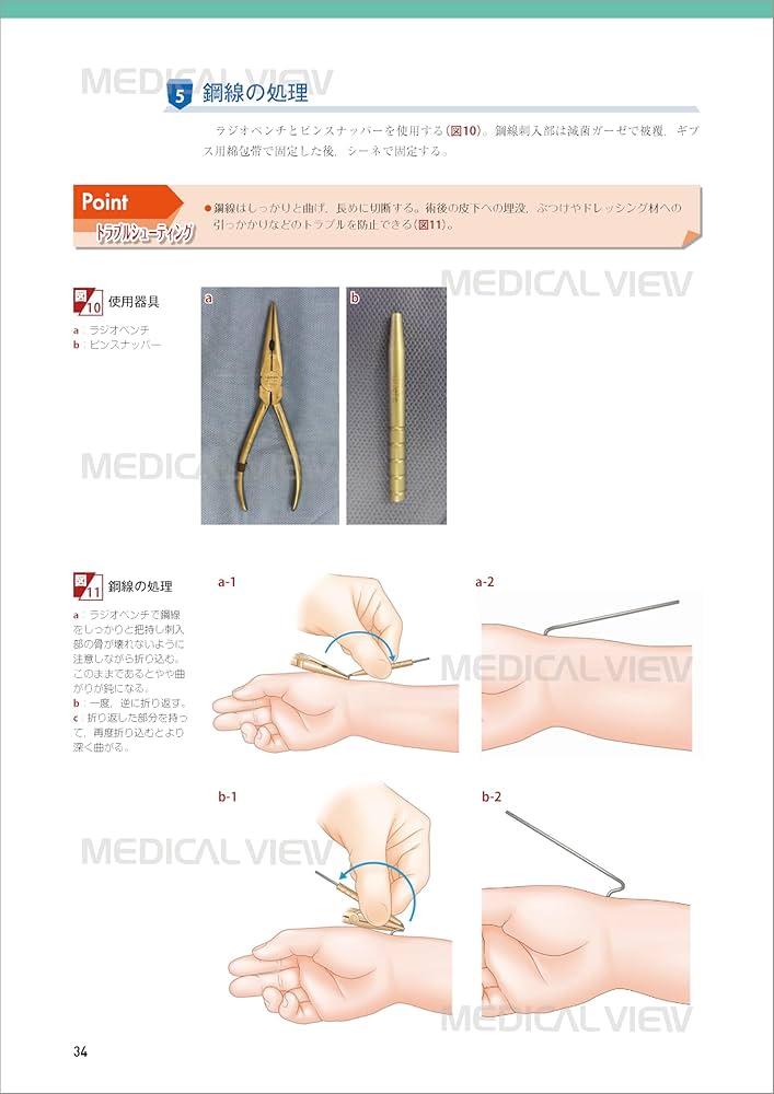 小児の骨折と手術［Web動画付］ (新OS NEXUS) | 大谷 卓也 |本