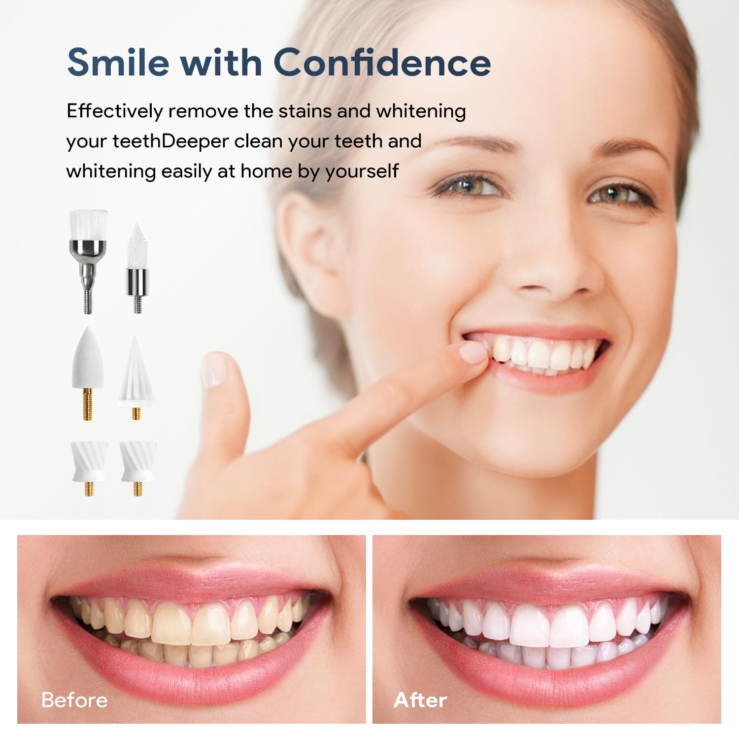 Cabezales de repuesto para pulidor de dientes, accesorios para eliminar sarro de dientes, 6 cabezales de cepillo variados, kit de cabezales de repuesto