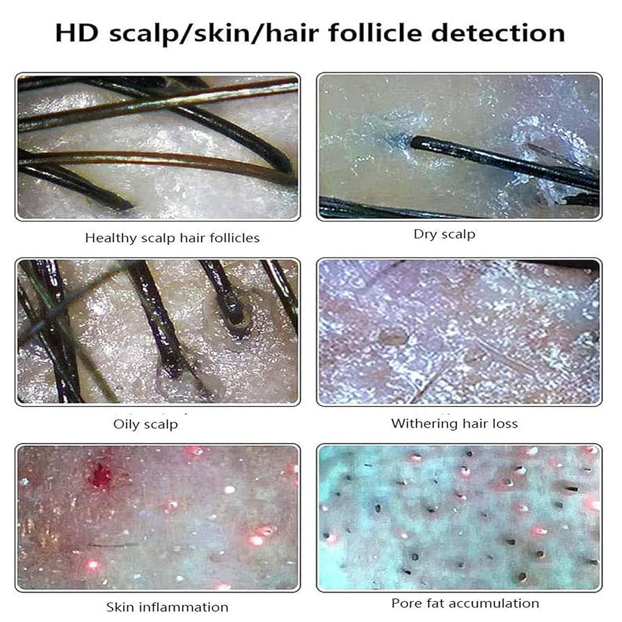 EXONINE SCALPCODE エクソソームフィルアップアクティベーター Exonine Scalpcode Exosome Fill-Up Activator Ampoule