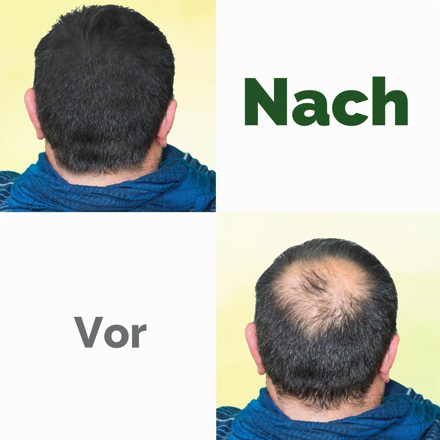 100% organisches, reines schwarzes Rizinusöl, kaltgepresst, für Haare, Augenbrauen, Wimpern, Wachstumsserum zum Wachsen von Wimpern, Rizinusöl für Haut, Körper, Gesicht, nicht raffiniert in