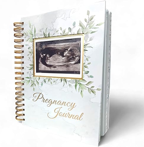 Pregnancy Journal Memory Book – Hardcover Baby Book For Moms, Ultrasound Window, Week-by-Week Guide & Keepsake Diary