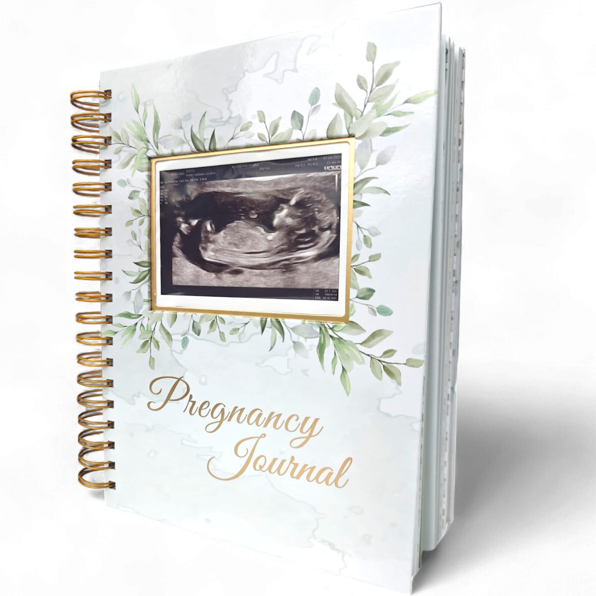 Pregnancy Journal Memory Book - Hardcover Pregnancy Book, First Time Moms, Baby Memory Book, Mom Book Diary, Ultrasound Baby Book Memory