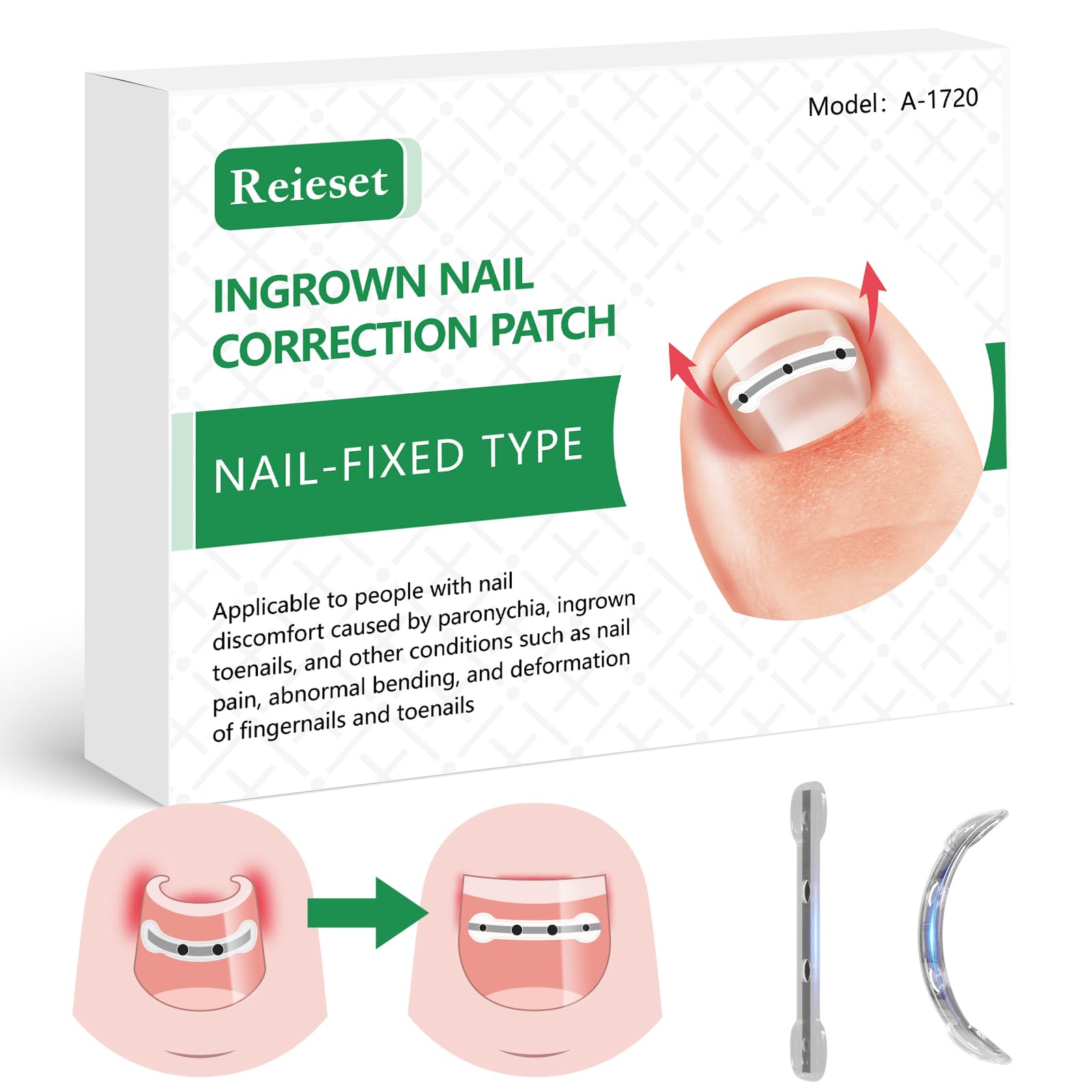 Reieset Titanium Alloy Ingrown Toenail Treatment Kit