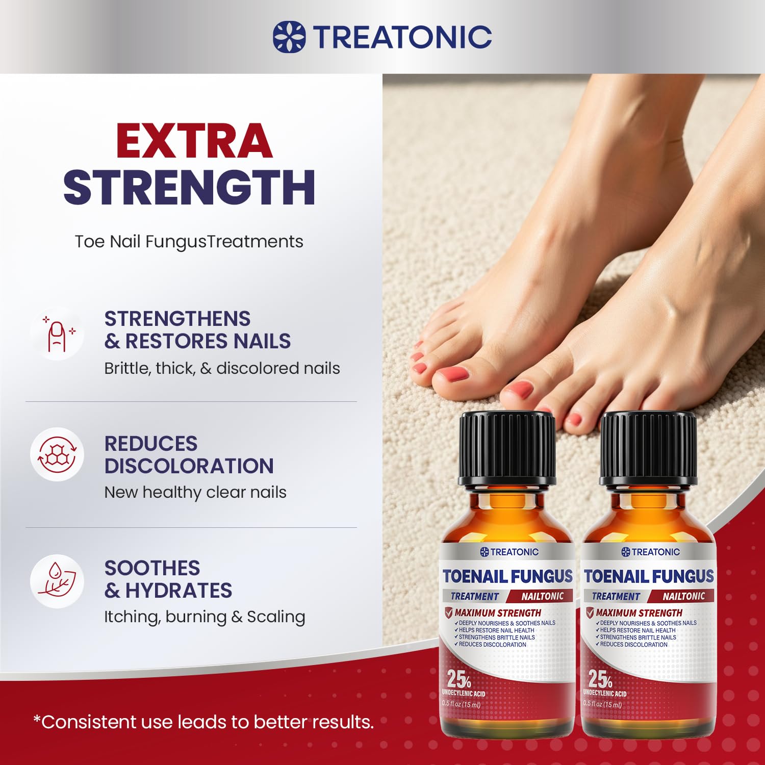 Treatonic Toenail Fungus Treatment Extra Strength: Antifungal Repair Solution with 25% Undecylenic Acid for Toe Nail Fungus Treatments - Restores Damaged & Discolored Nails Appearance - 2 Bottles - Image 3