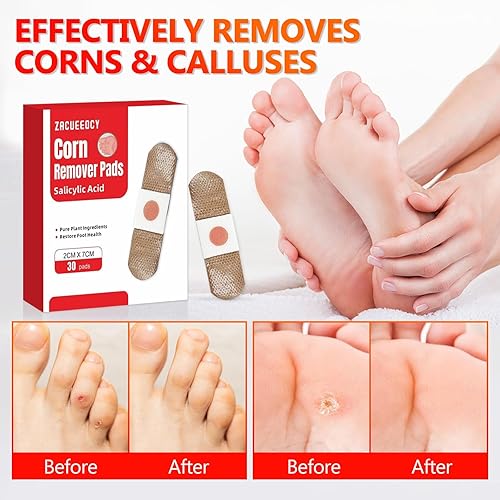 Miniatura 6 de Almohadillas removedoras de maíz para pies paquete de 30 unidades con tratamiento extra fuerte con ácido salicílico al 40% - vendajes medicados