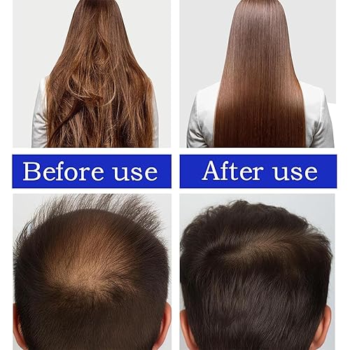 Miniatura 3 de Aceite de batana crudo para el crecimiento del cabello, 100% aceite de batana orgánico para el crecimiento del cabello, aceite de batana de