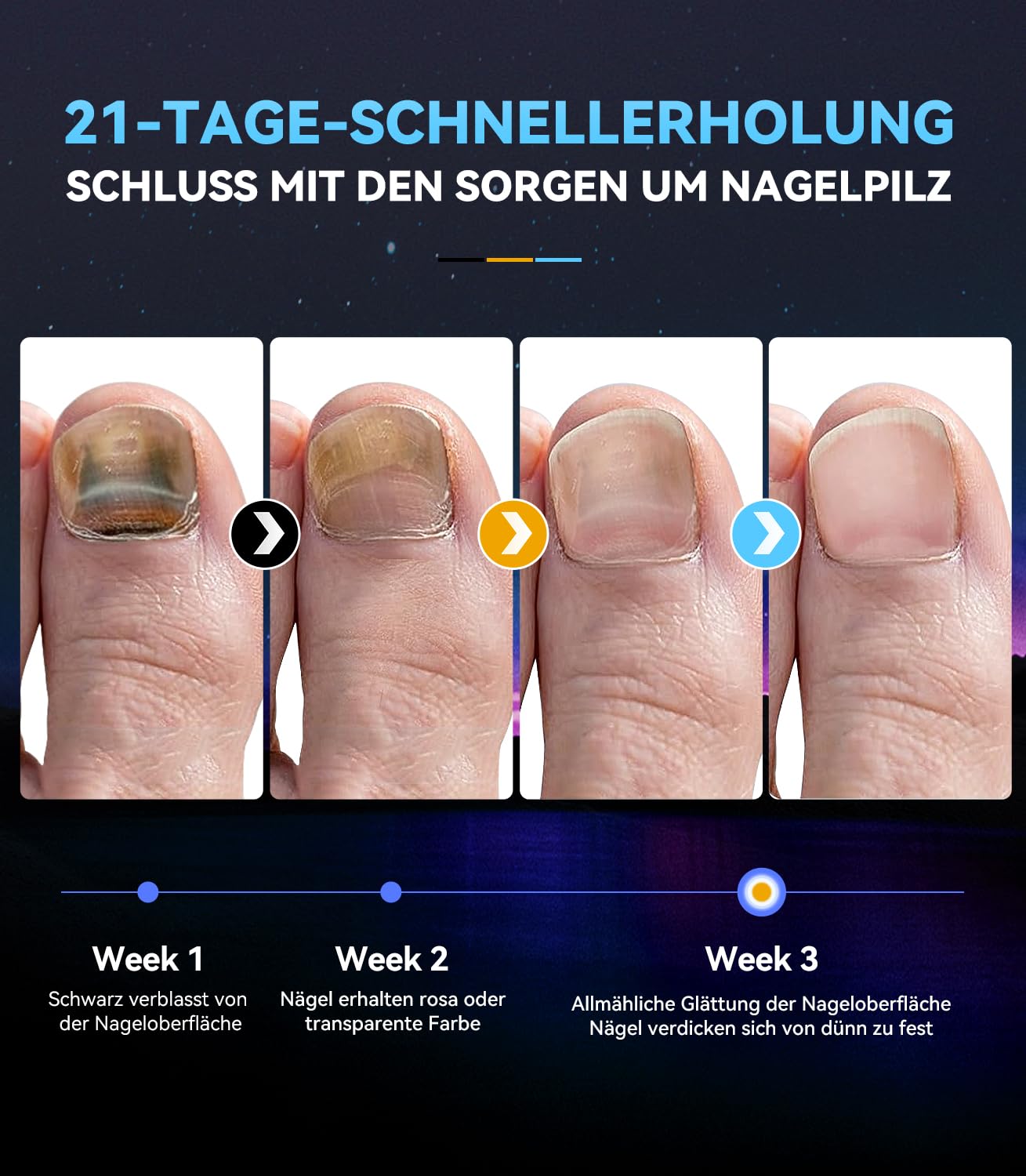 PRO-Gegen Nagelpil Laser Gerät【7 Tage Schnell Wirkende】【Mit intelligenter Zeitanzeige - zeitgesteuert 30/60/99】365nm Infrarot-Licht 405nm Blau Tragbares Wiederherstellung gesunder Antimykotischer