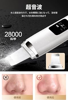 Amazon.co.jp: ウォーターピーリング 【28,000回/s振動&1台4役