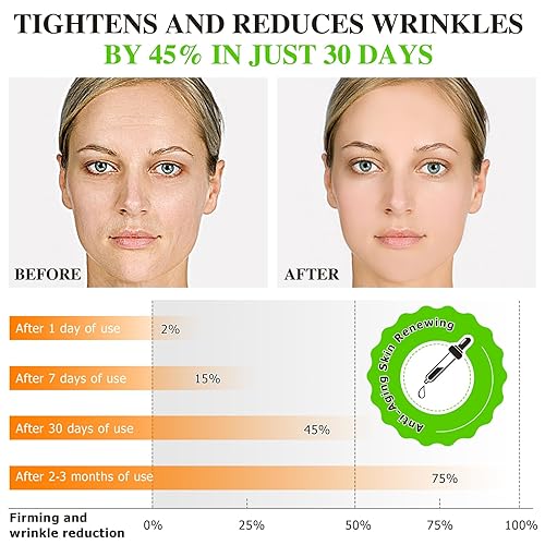 Miniatura 4 de Suero facial prémium al 20% de vitamina C para cara y cuello, antienvejecimiento y arrugas con vitamina C, ácido ferúlico, vitamina E, colágeno de