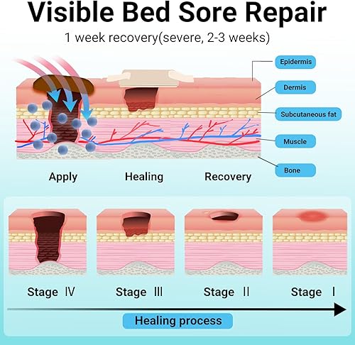Miniatura 6 de ishancare® Crema para el dolor de cama – Crema natural rápida y segura para el dolor de presión, ungüento curativo para el cuidado de heridas por