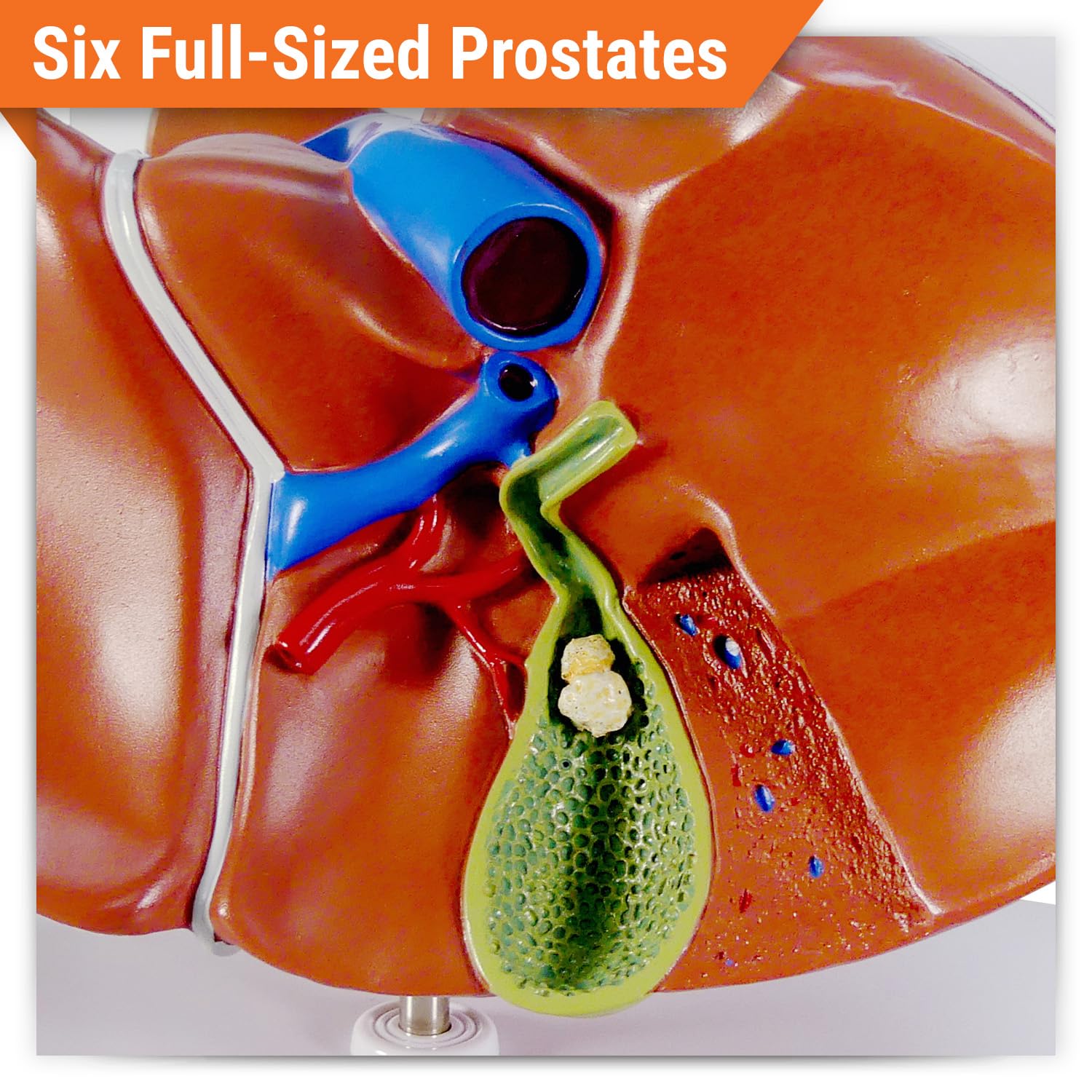 GPI Anatomicals - Liver and Gallbladder Model, Replica of Digestive System with Gallstones for Human Anatomy and Physiology Education, Anatomy Model for Doctor's Office, Medical Learning Resources