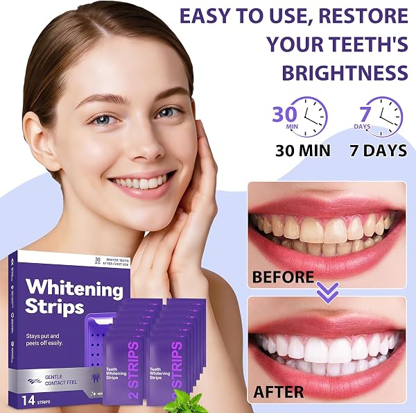 Strisce Sbiancanti Denti Viola – Sbiancamento Denti Rapido a Casa – Sbiancante Denti per Denti Sensibili – Rimuove Macchie Caffè Fumo Vino – 14 Strisce Teeth Whitening Strips - 3