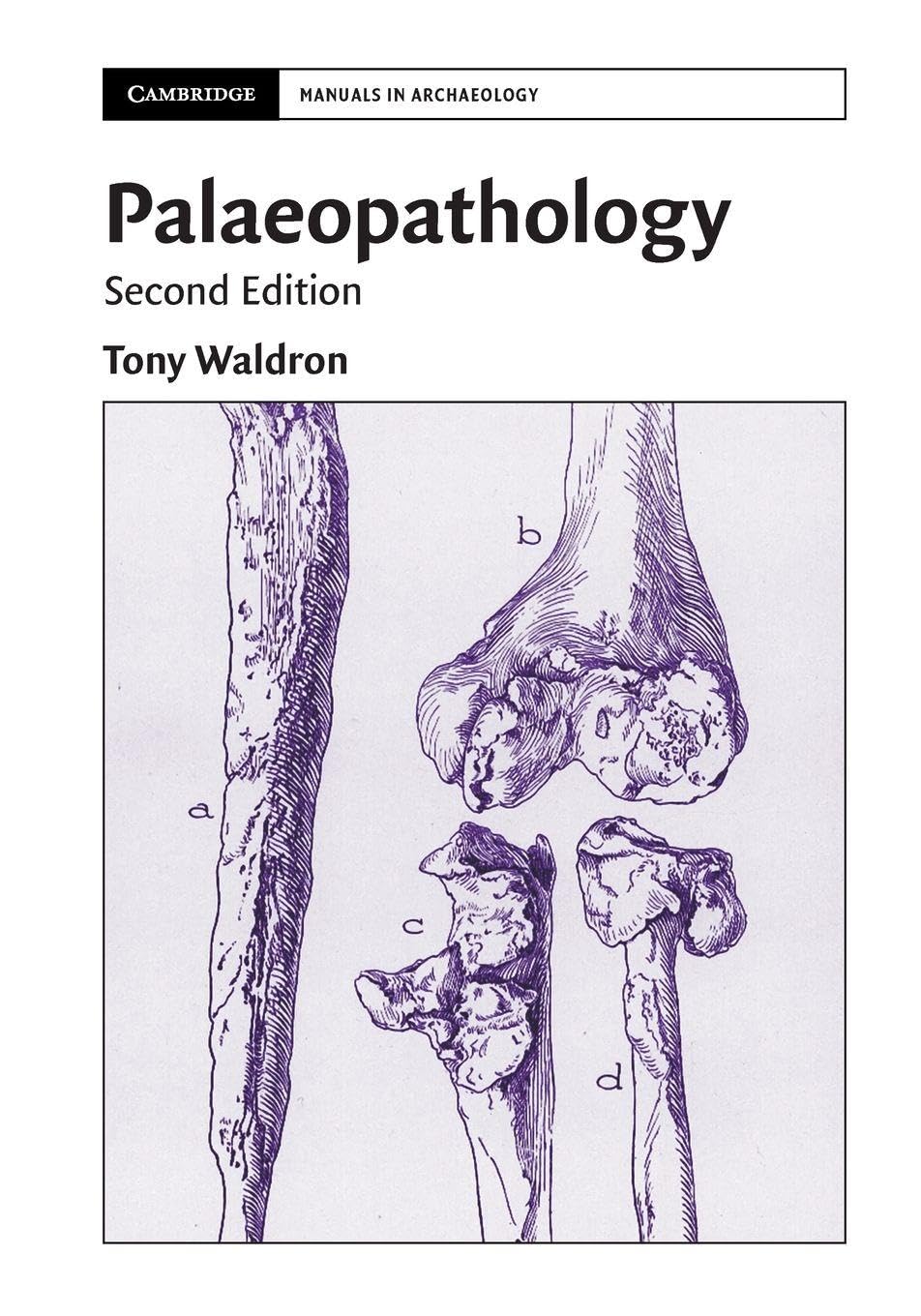 Palaeopathology (Cambridge Manuals in Archaeology)