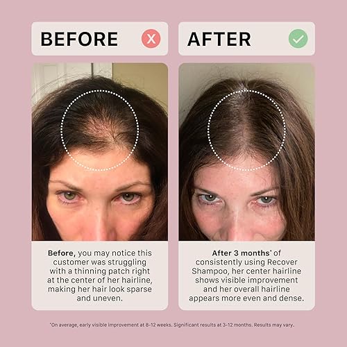 Miniatura 6 de ACTIIV Recover Travel Duo para mujer  Apoya la apariencia de un cabello más completo y saludable, a base de plantas, seguro para el color, vegano,