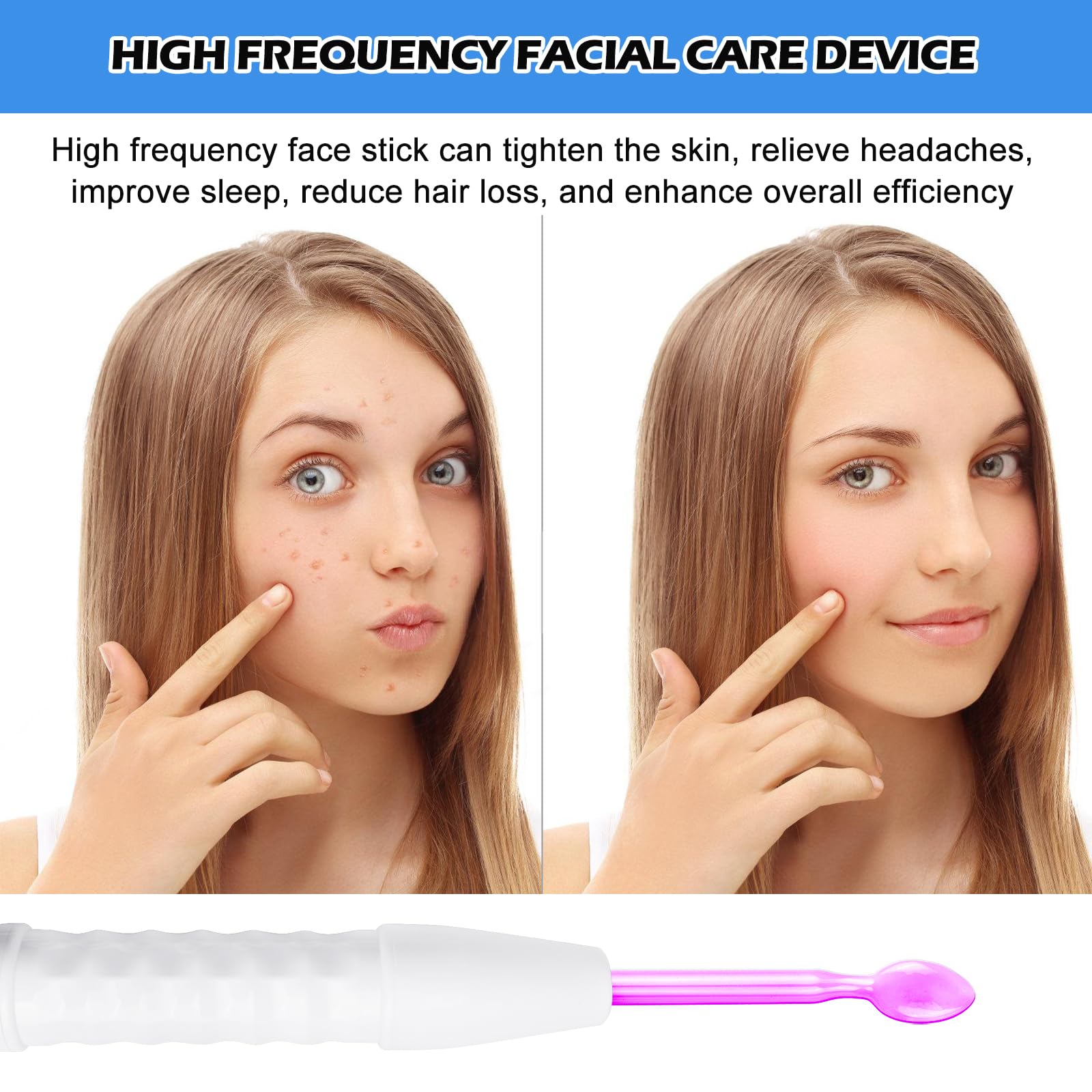 Varilla de alta frecuencia para la cara, pared de alta frecuencia con 6 sondas, acné de alta frecuencia, máquina facial de belleza para tonificar la piel, reducción de arrugas, acné, pérdida de