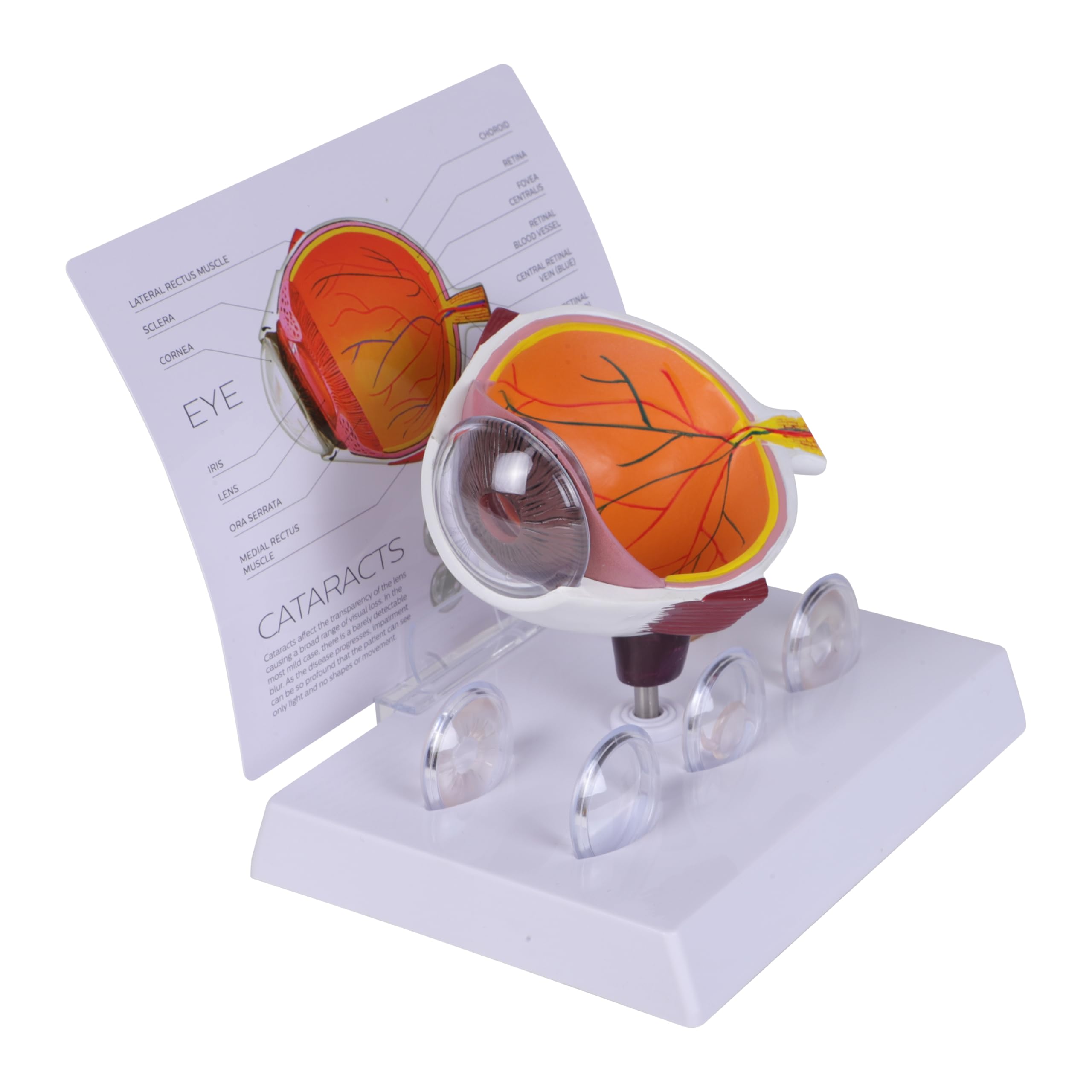 KKI Human Cataract Eye Anatomical Model with 5 Interchangeable Lenses Perfect Anatomy Replica for Medical Students, Doctors and Training (B08NGM6QD9) Amazon Price History, Amazon Price Tracker