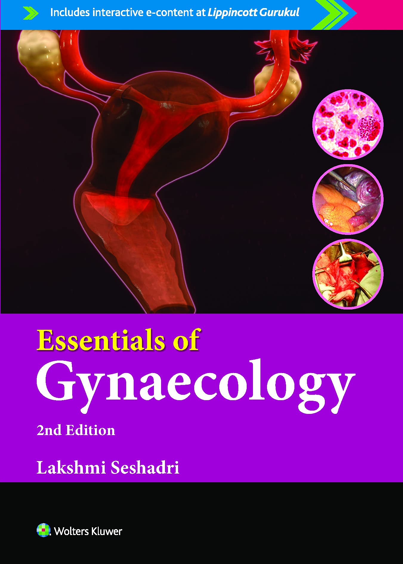 Essentials of Gynaecology, 2/e