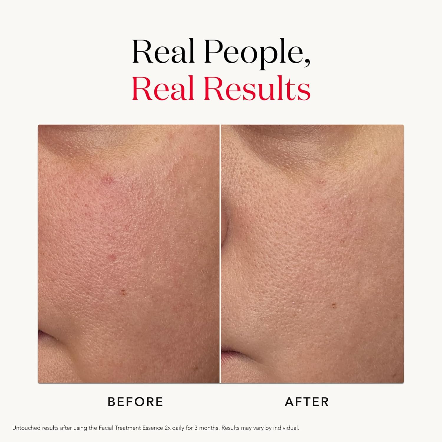 SK-II Facial Treatment Essence - Anti-Aging Essence Skincare to Help Reduce the Appearance of Fine Lines & Wrinkles - Visibly Refines Texture & Improves Firmness & Dark Spots