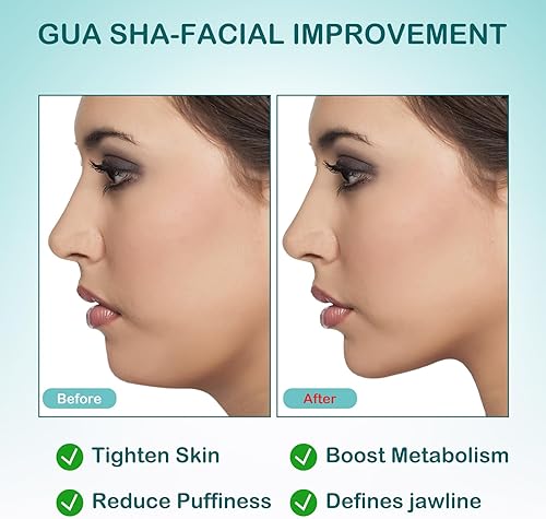 Miniatura 4 de Upgrade Medical - Herramienta médica de acero inoxidable Gua Sha 316L, raspador de masaje para tensión muscular, sistema LYMP, herramientas faciales