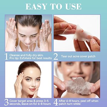 Vigorder Nose Pore Patches, Hydrocolloid Nose Patches, Targets Pimple, Pores & Oil, Acne Strips to Absorb Acne Gunk Overnight (10 Pack)