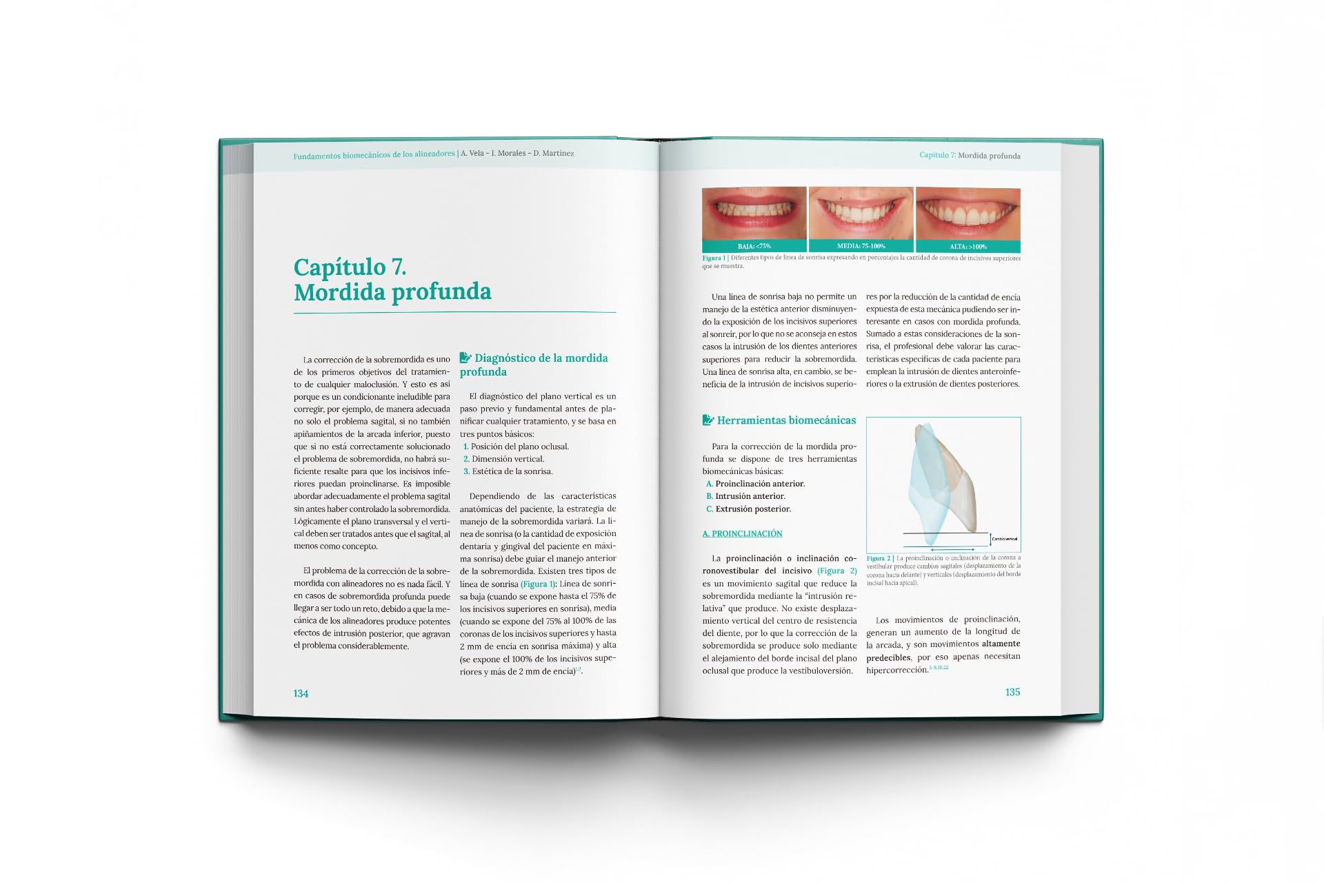 Fundamentos biomecánicos de ortodoncia con alineadores