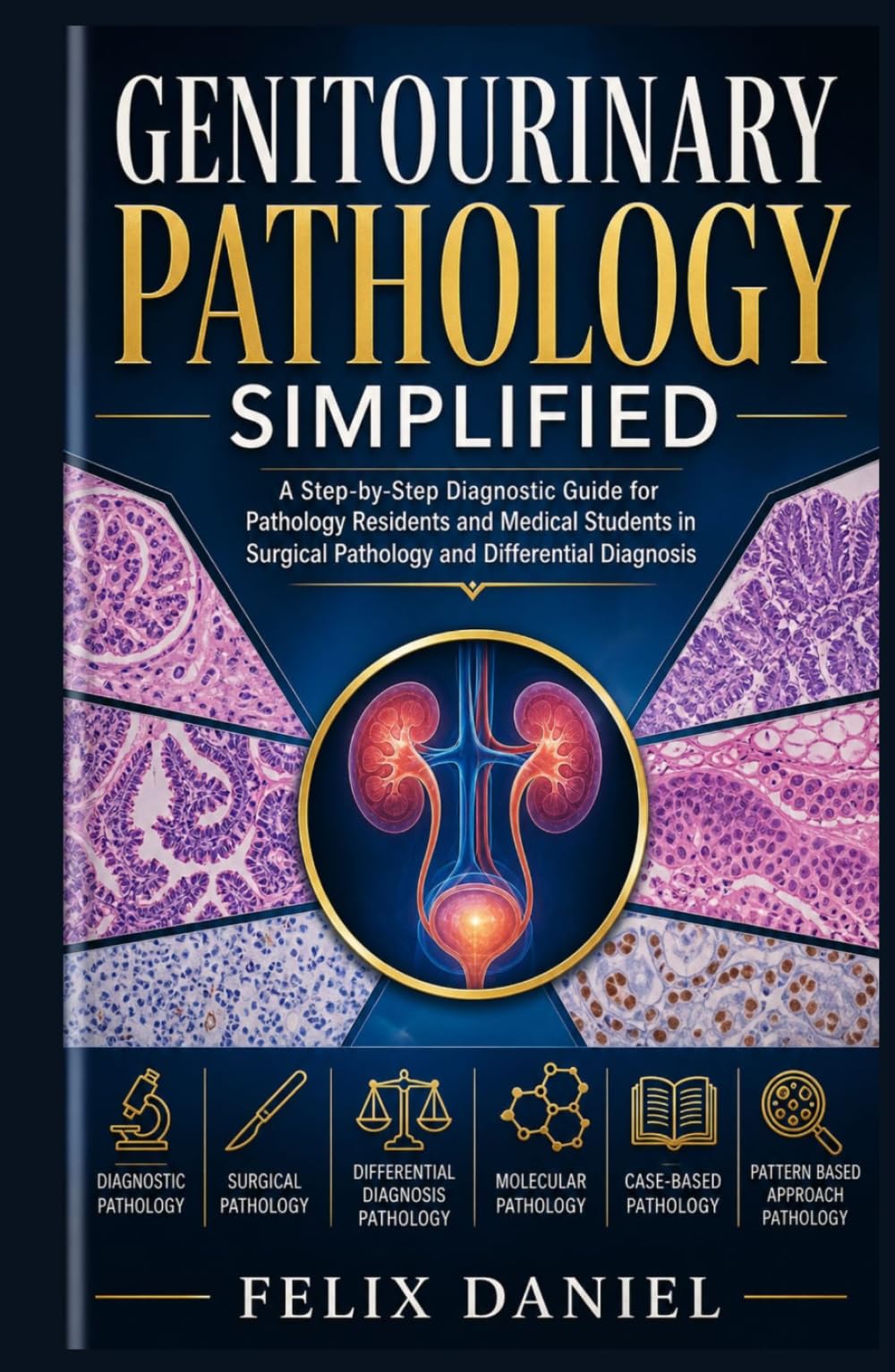 Genitourinary Pathology Simplified: A Step-by-Step Diagnostic Guide for Pathology Residents and Medical Students in Surgical Pathology and Differential Diagnosis