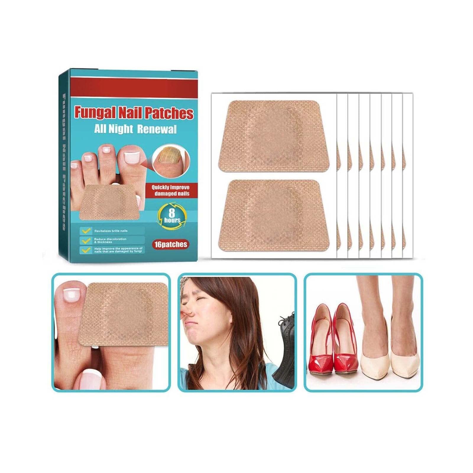 NALACAL Anti Fungal Nail Treatment Patches, Toe Fungus Onychomycosis Repair S-ticker (2 boxes)