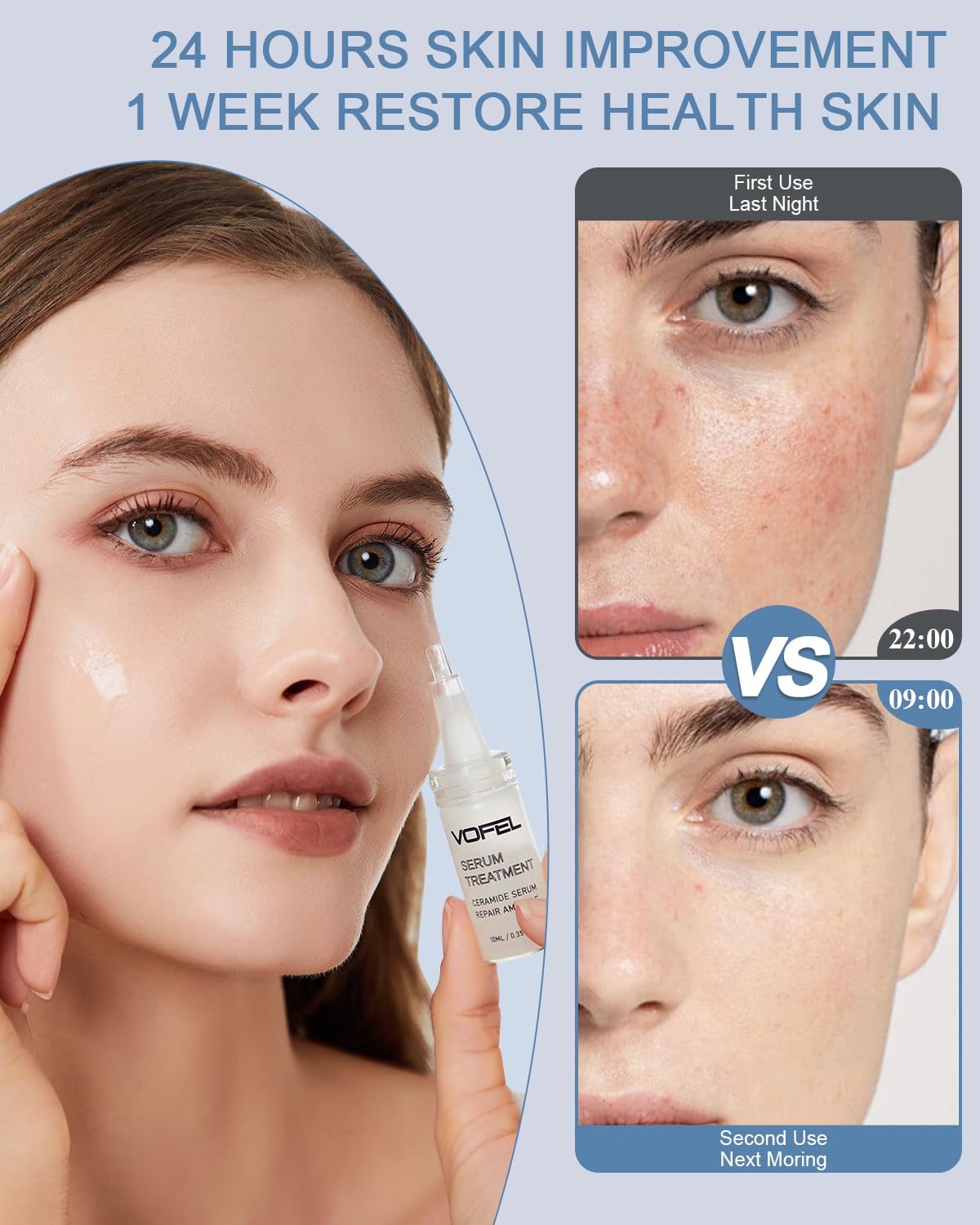 Ceramide Serum for Skin Barrier Repair, 5% Ceramide Face Serum Ampoule Solution 2 Vials - Image 4