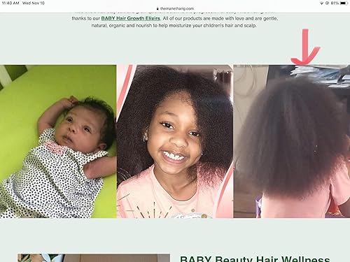 Miniatura 4 de Aceite para el crecimiento del cabello del bebé, aceite orgánico para recién nacidos con aceites de coco, oliva, ricino y árbol de té