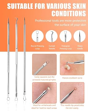 8 PCS Blackhead Remover Tool Kit, Stainless Steel Extractors | Professional Blackhead Remover Comedone Extractor Tools For Blackheads, Whiteheads And Blemishes With Stainless Steel Design