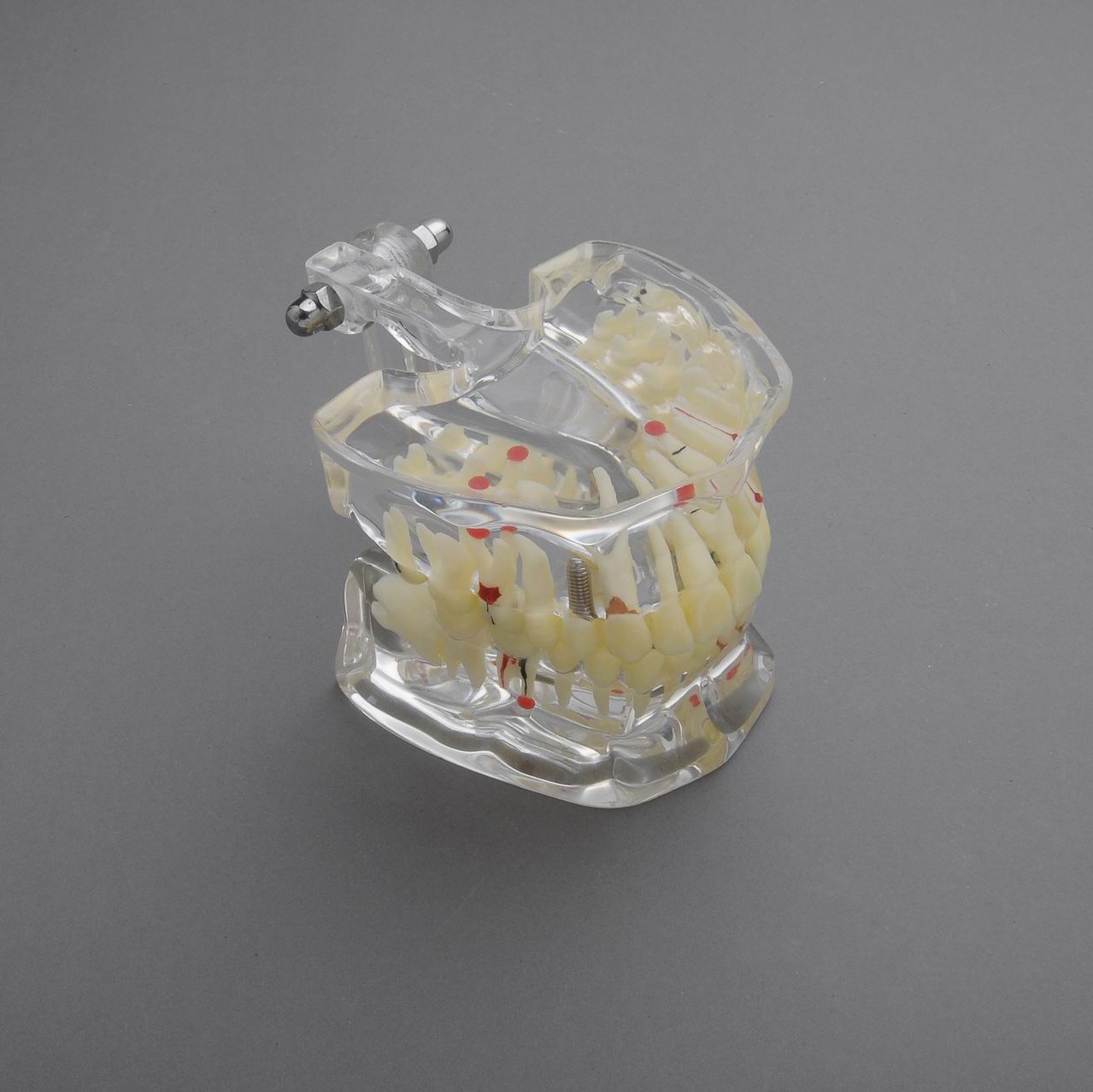 J&J Ortho General Adult Pathology Dental Model