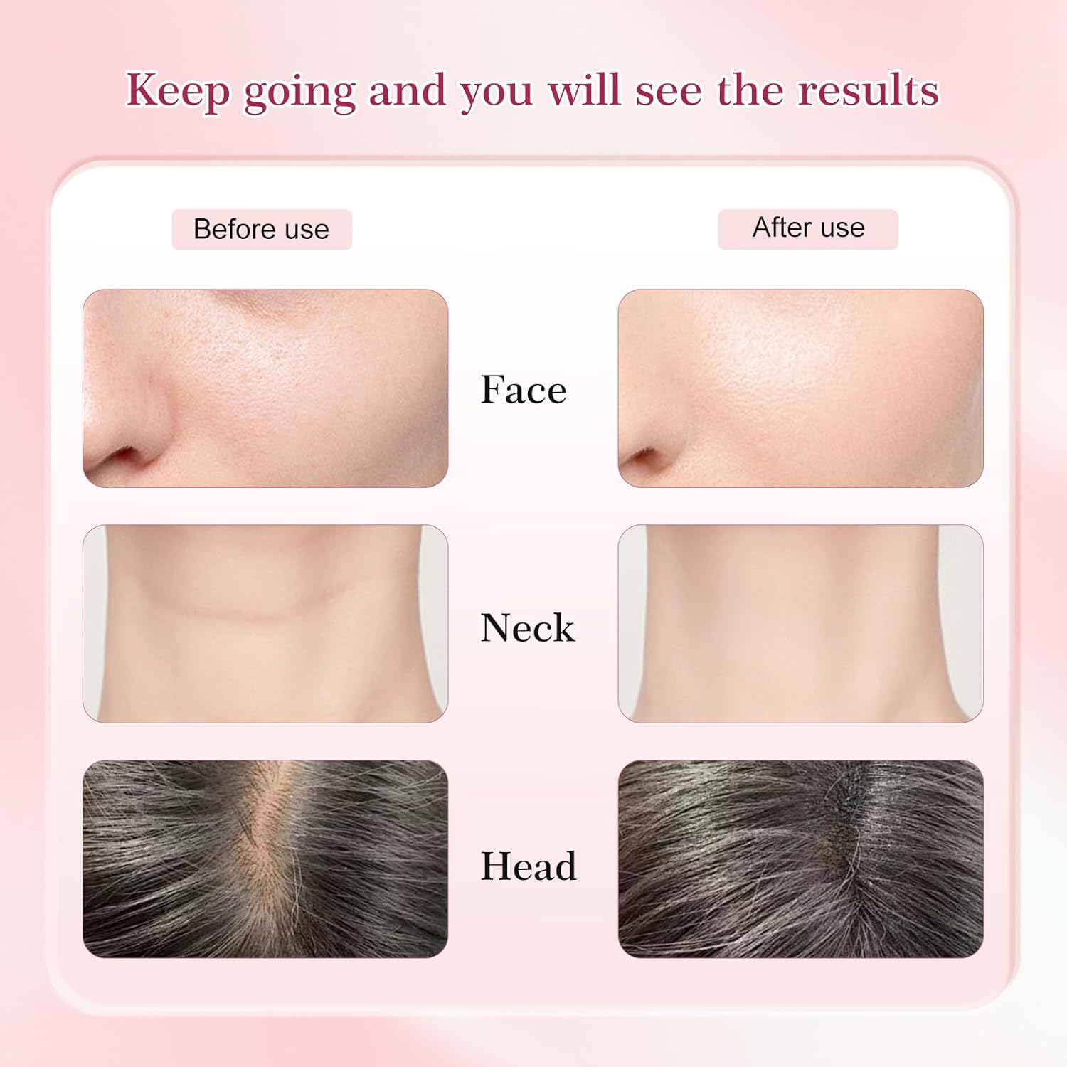 New Red-Light-Therapy-for-Face and Neck-Eye-Head Massager,7 Colors Skin Rejuvenation Lifting Facial Massager for Toning,Glow Boost,Wrinkle for Birthday, Christmas, Mothers Day, Valentines Day Gifts - Image 6