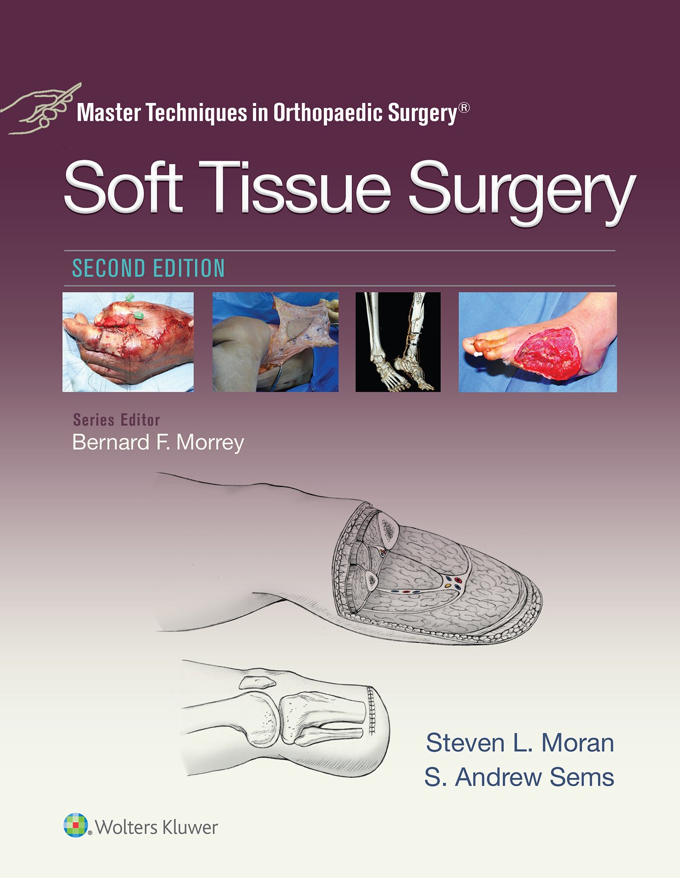 Steven MoranMaster Techniques in Orthopaedic Surgery: Soft Tissue Surgery