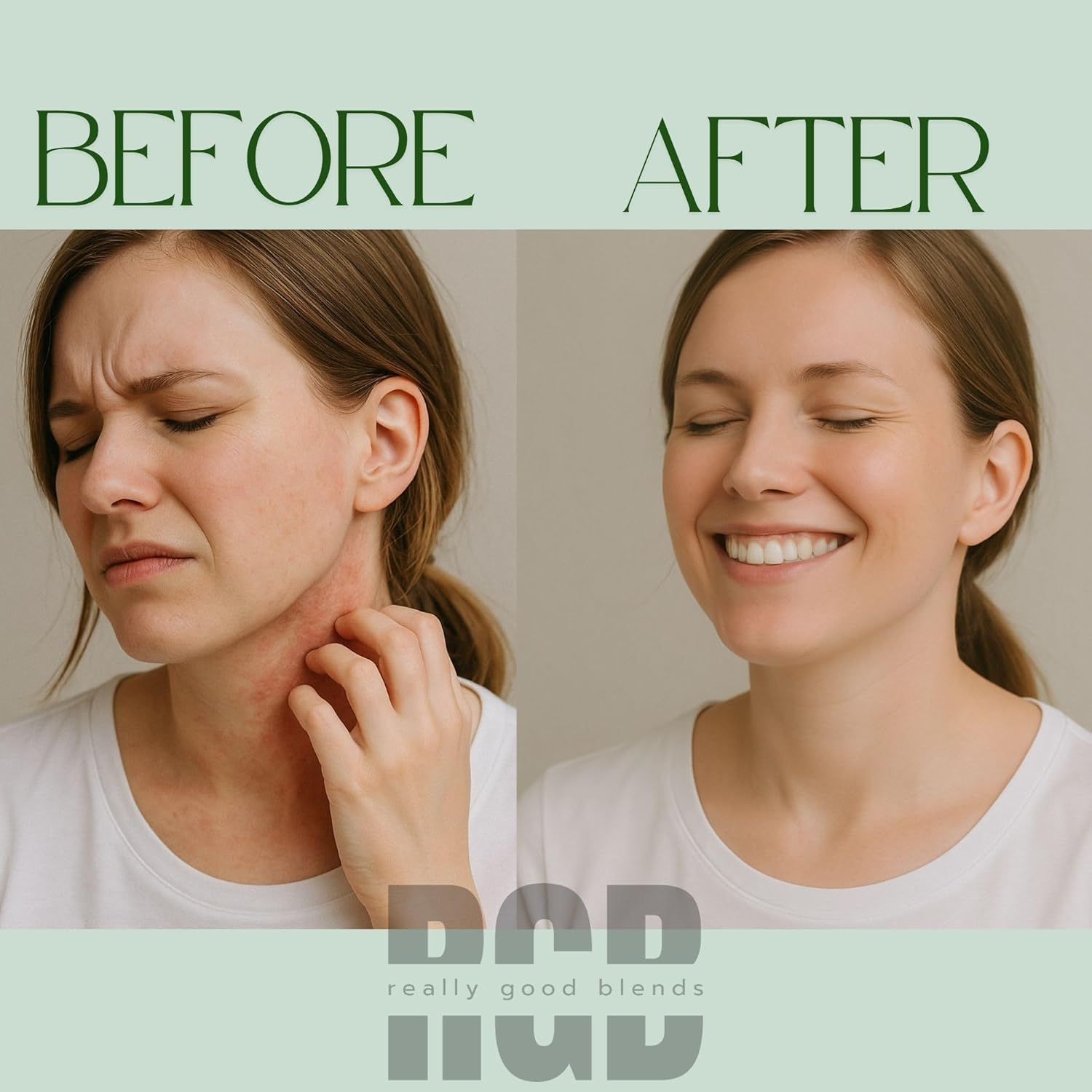 Whipped Tallow Balm with Manuka Honey – 4 oz | Collagen-Boosting Body Butter | 100% Organic Beef Tallow Moisturizer with Gotu Kola and Rosehip | Face, Body, and Skin Cream | Made in USA (Unscented)