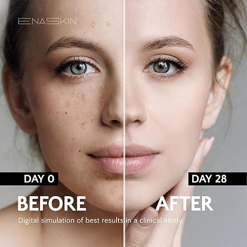 Miniatura 5 de EnaSkin Eliminador de manchas oscuras para rostro y cuerpo crema corrector de manchas de fórmula avanzada para desvanecer manchas de la edad,