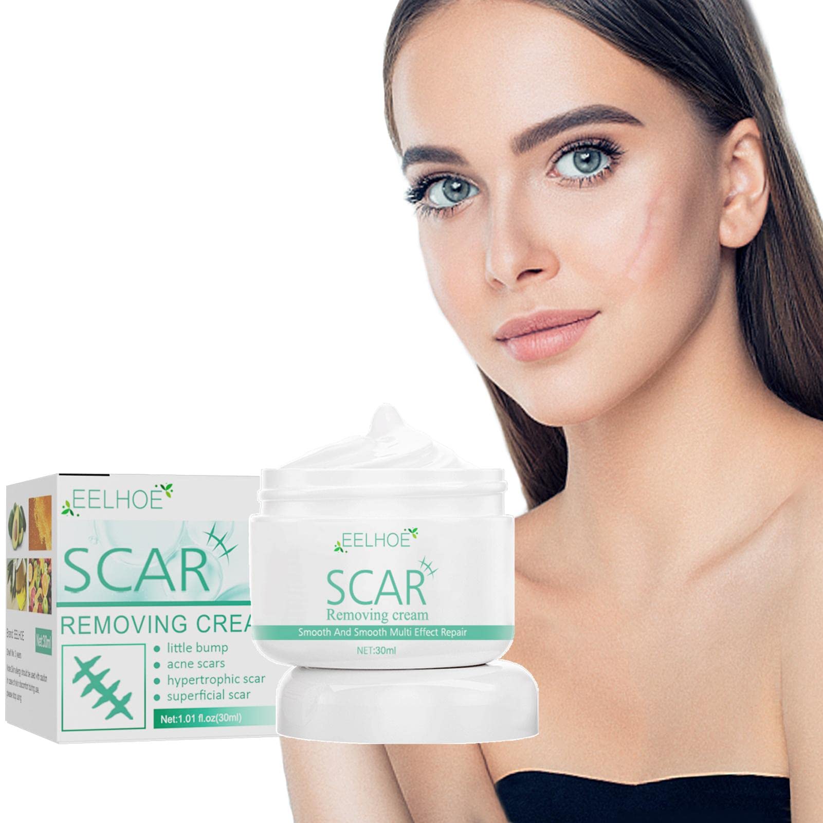 Orogoo Stretch Marks Removal Cream,Scar Reducing Treatments Cream | Scar Repair Cream for Various Old & New Scars, Stretch Marks, Injuries, Burns, Acnes Spots, Scratches