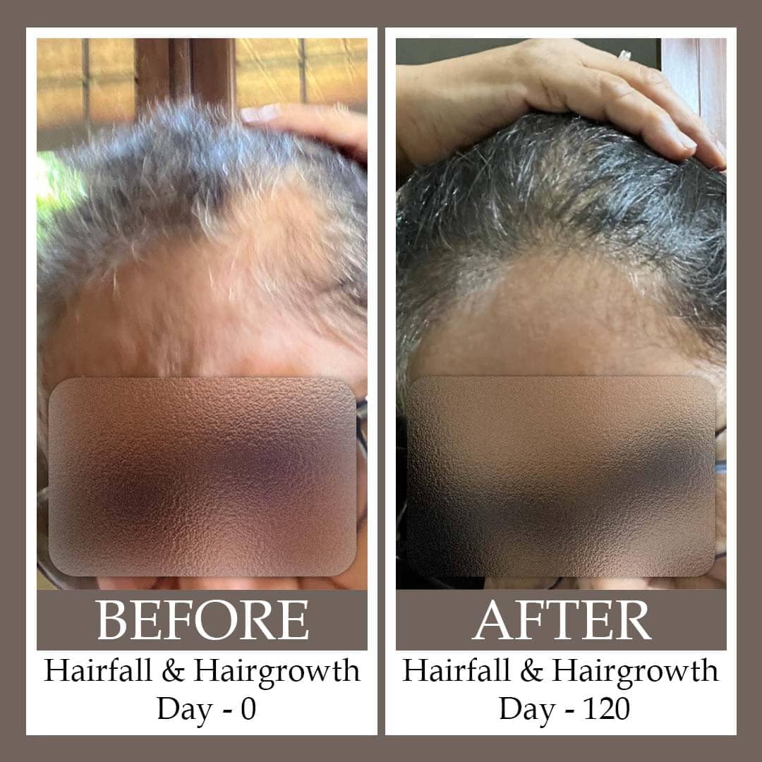 ESSENTIALS Hair Serum - For All Hair Types - Protects Against Hair Loss, cream-coloured - Image 4