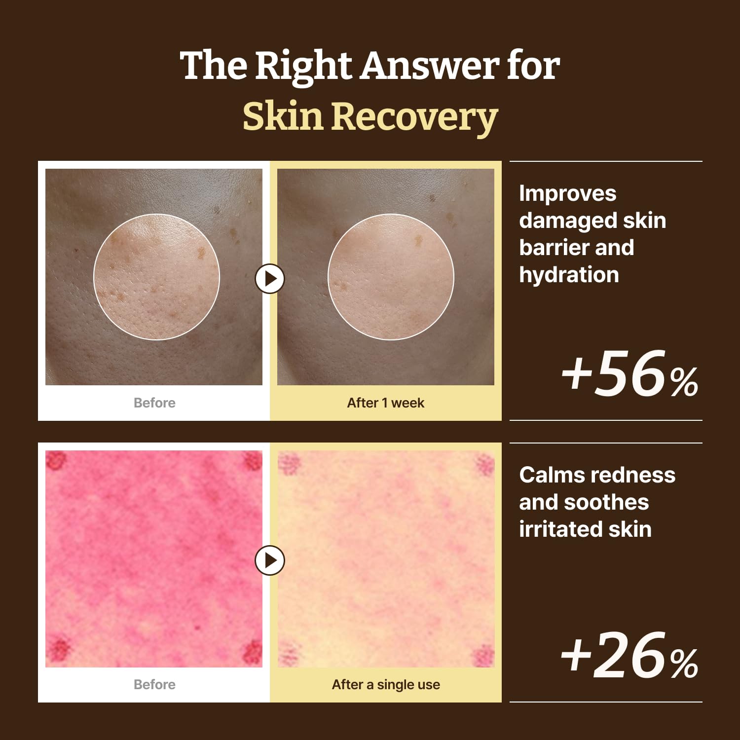 Dr. Reju-All Heal & Shield Duo: Advanced PDRN Rejuvenating Cream + Advanced LC-Cera... - Image 6