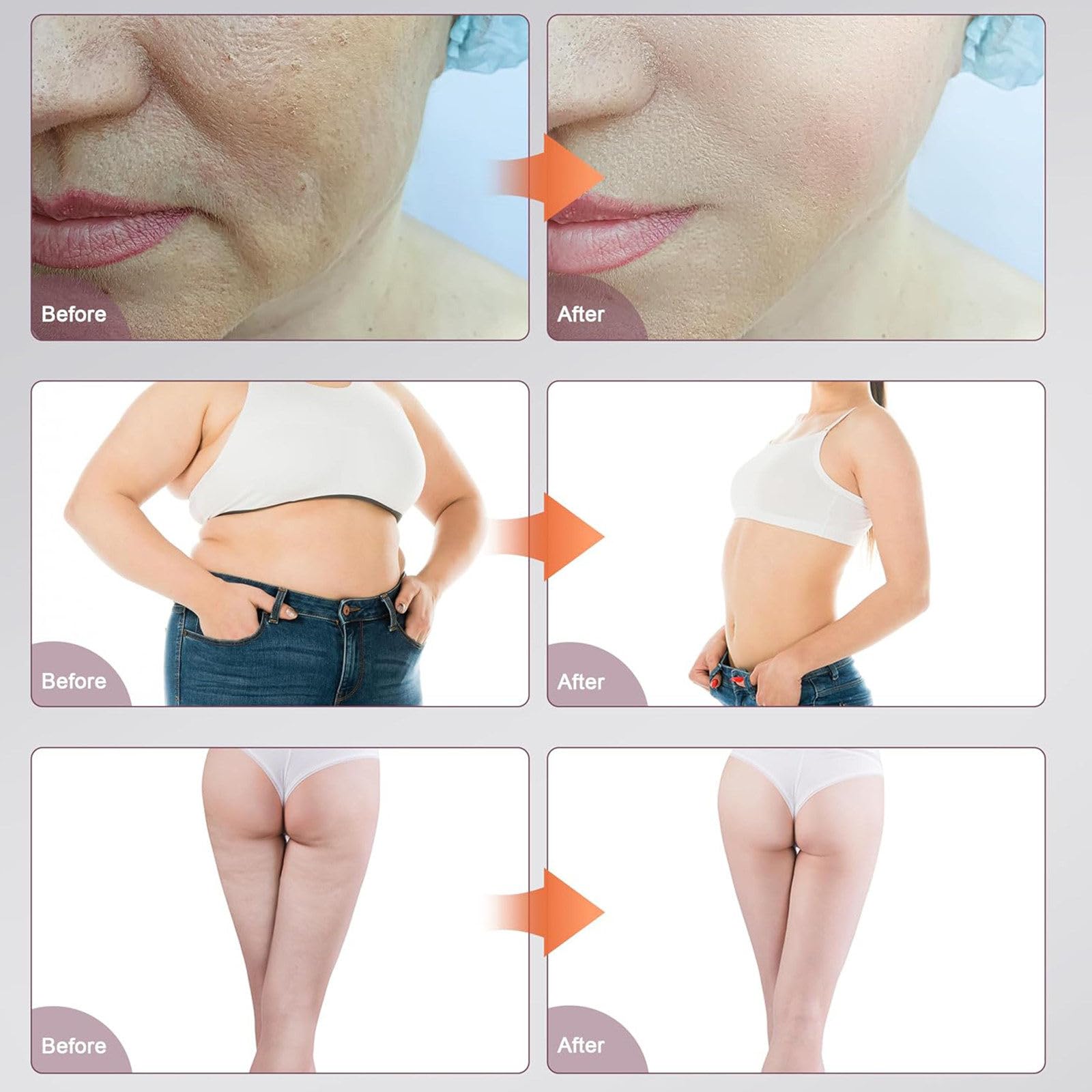80K Kavitationsgerät, 9-in-1-Körperformungsgerät Professionelle Hautstraffung, Vakuum-Unterdruckkopf – Einstellbarer Abstreif-Saug- Und Freigabemodus, Photorejuvenation B