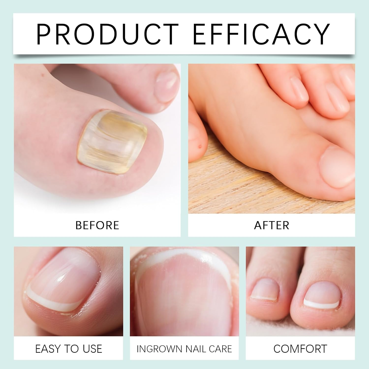 Natural Nail Repair Care Gel | Nail Growth Repair Serum, Foot Care Cream, Moisturizing