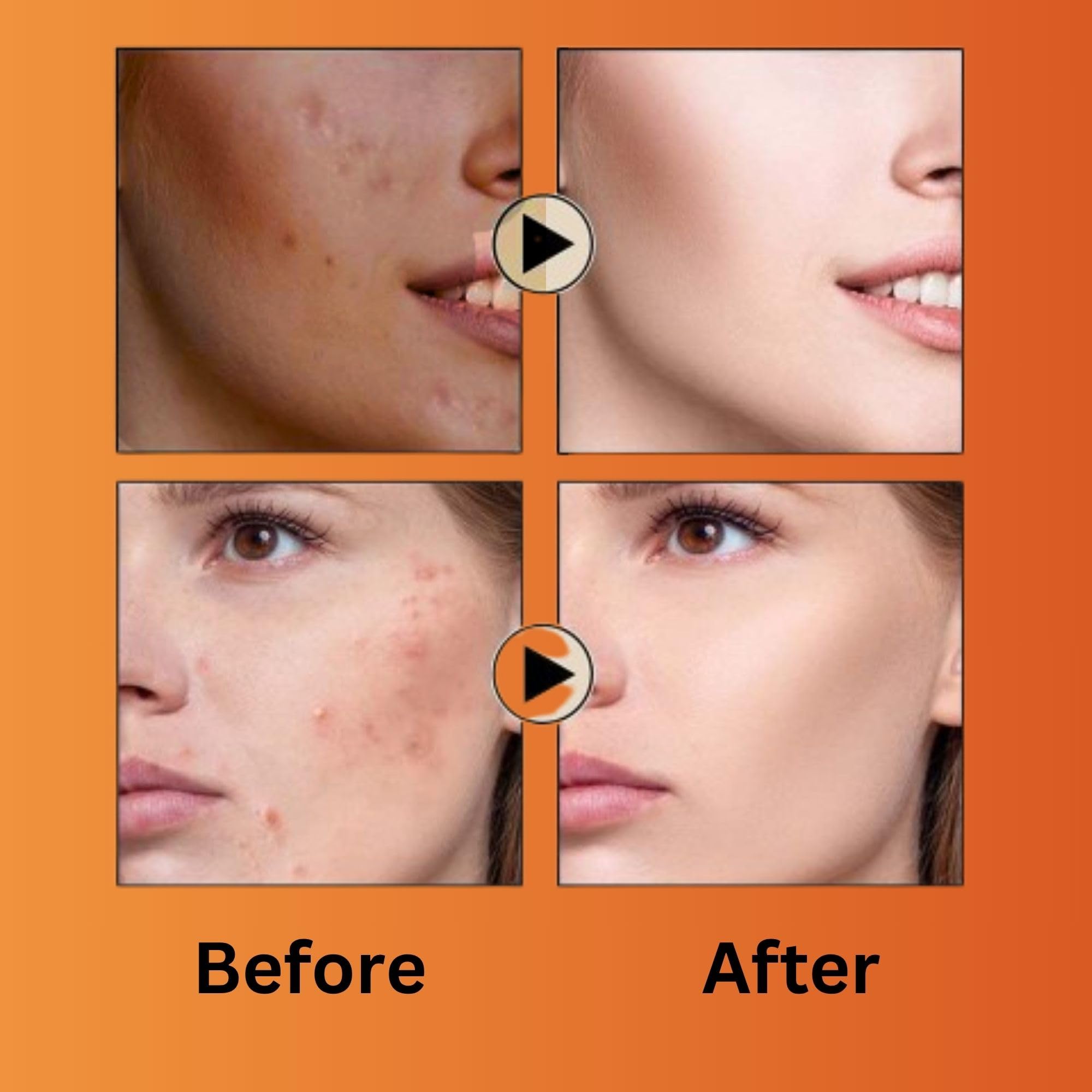 glutathione face cream benefits Glutathione Face Cream & Vitamin C Moisturizer for Pigmentation & Glow – EABHAA