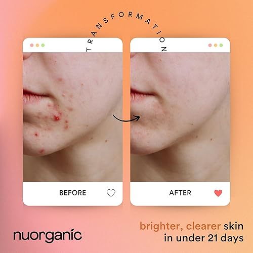 Miniatura 5 de NuOrganic - Máscara facial de cúrcuma con arcilla de caolín, té verde y aloe vera, calma, limpia e ilumina, perfecta para el acné o la piel