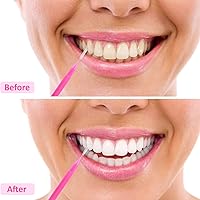 Vista 7 de Patelai 100 piezas de cepillos para limpiador, cepillo interdental, palillo de dientes, cabezal de hilo dental, hilo dental, higiene dental, hilo