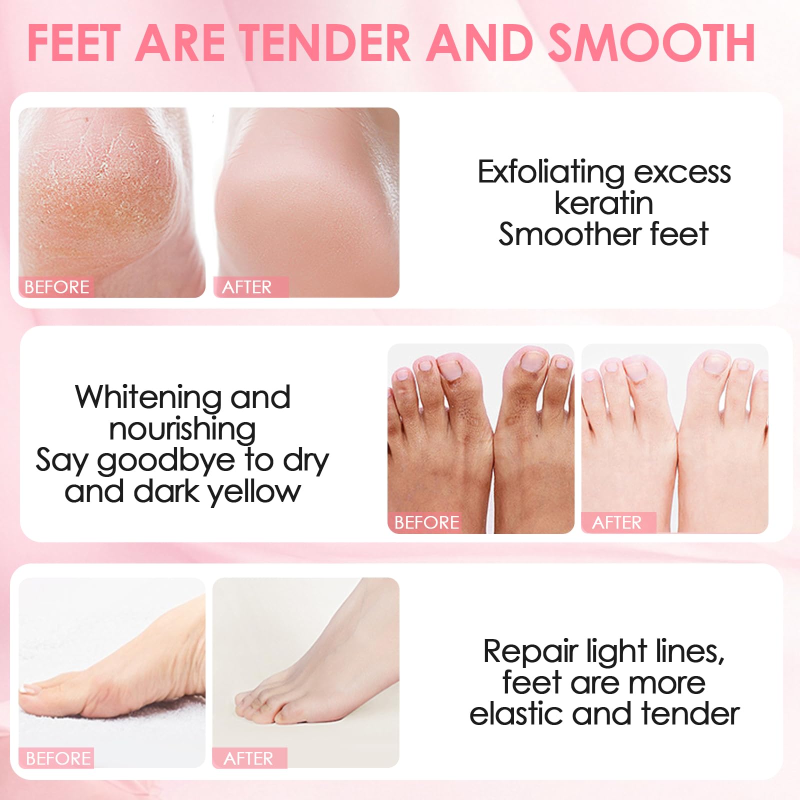 2 Paia Maschera Piedi Esfoliante, Trattamento Peeling Intenso, Peeling Delicato, Trattamento per Talloni Ruvidi, Pelle Liscia, Effetto Idratante Prolungato (Rosa/Aloe)