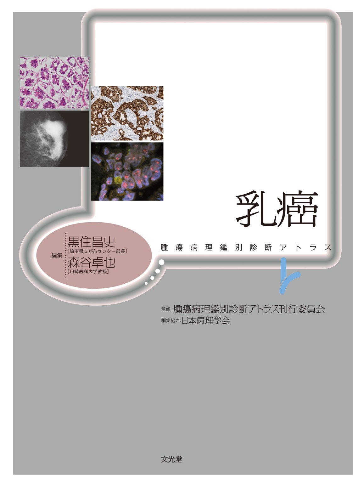 腫瘍病理鑑別診断アトラス　乳癌 乳癌 | 株式会社文光堂