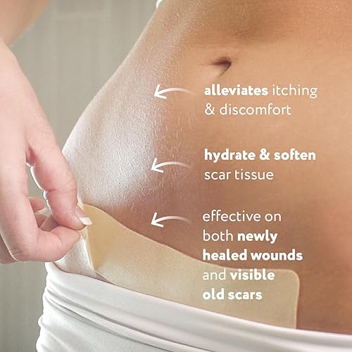 Miniatura 4 de ScarAway Hojas avanzadas de silicona para cicatrices de sección C, hojas reutilizables (1.5 x 7 pulgadas) para cicatrices hipertróficas y queloides