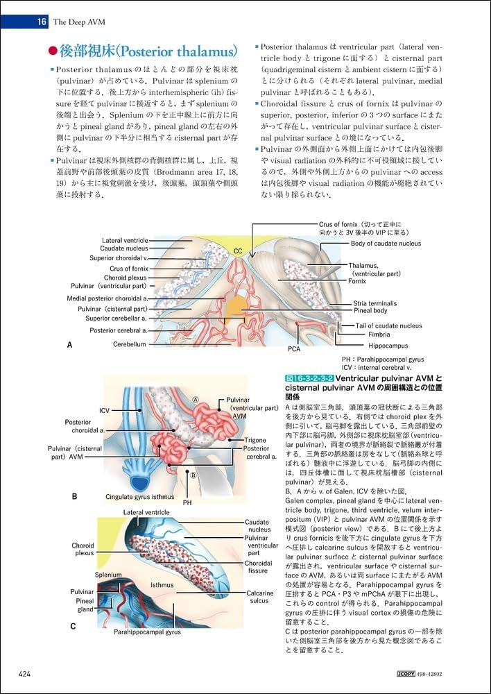 脳動静脈奇形の手術 | 富永 紳介 |本 | 通販 | Amazon